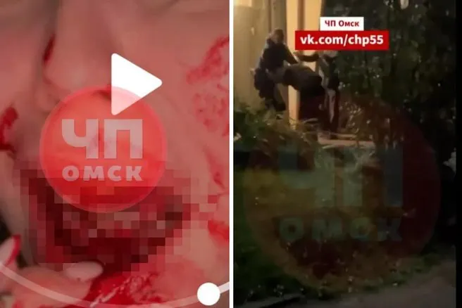 Ночью на улице 2-й Любинской в Омске мужчина избил девушку из-за телефонного разговора, нанеся ей тяжёлые травмы: выбито 4 зуба, повреждена челюсть, рассечена губа. Личность агрессора установлена, проводится проверка.